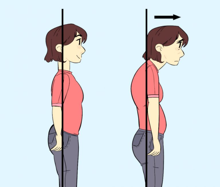 Forward Head Posture – A Pain In The Neck – ThreeSixty Osteopathy