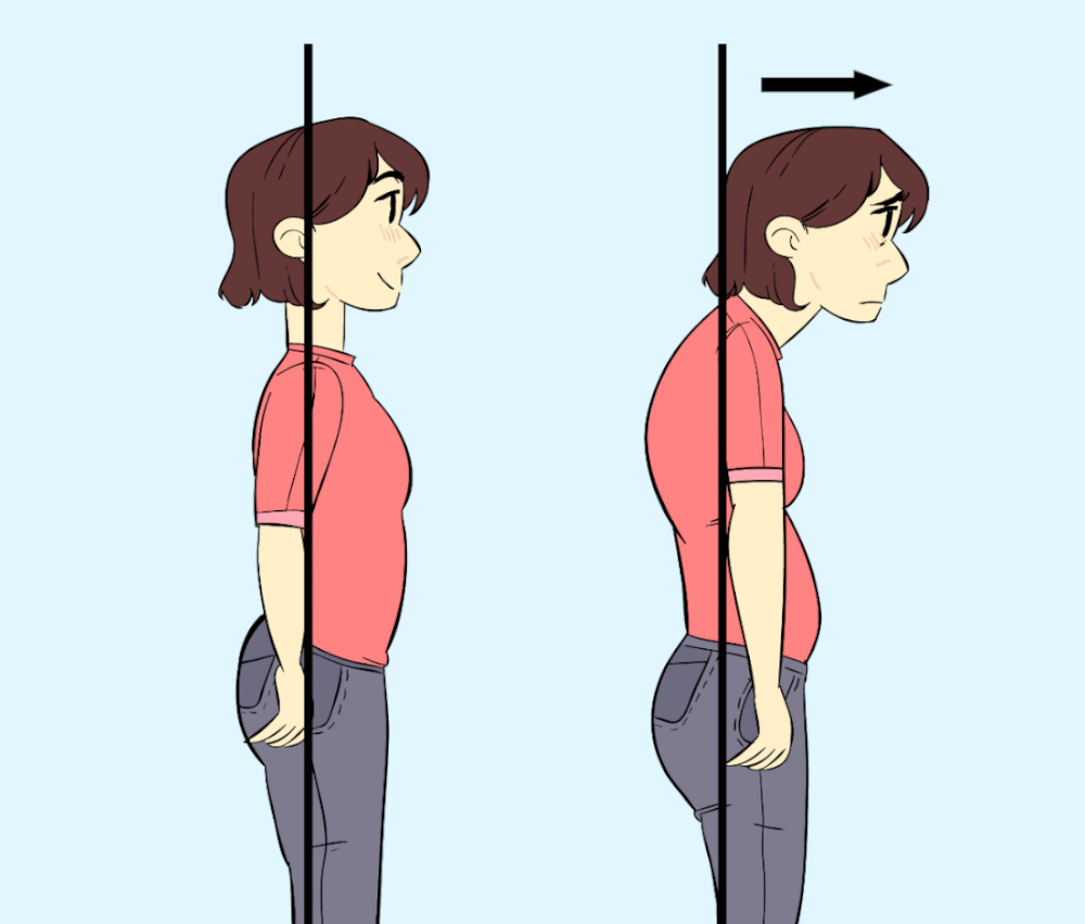 Poor Posture: Is It Bad For My Health? – ThreeSixty Osteopathy